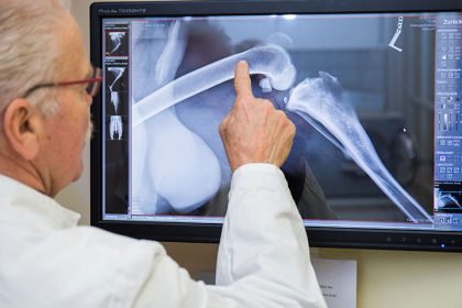 Digitales Röntgen. Dr. Hutter sieht sich ein Röntgenbild am Computer an