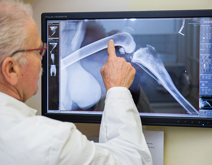 Digitales Röntgen. Dr. Hutter sieht sich ein Röntgenbild am Computer an